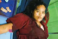 Mastiana (27) korban dalam insiden. Foto: Herdi/Siberbengkulu.co